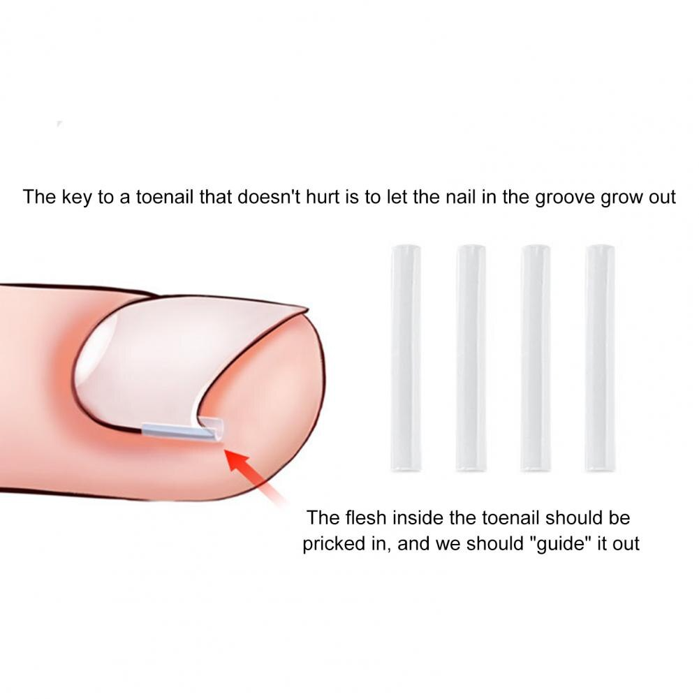 How to apply the unique toe nail support pad