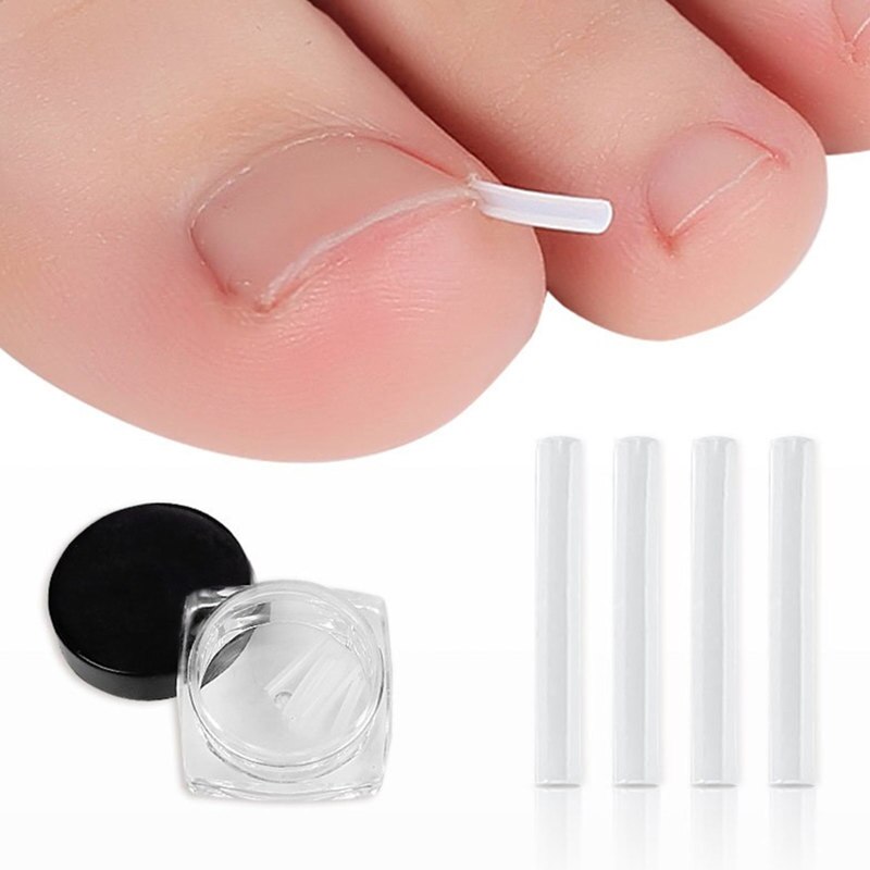 Toe Nail Support Pad as a thoughtful lifestyle gift