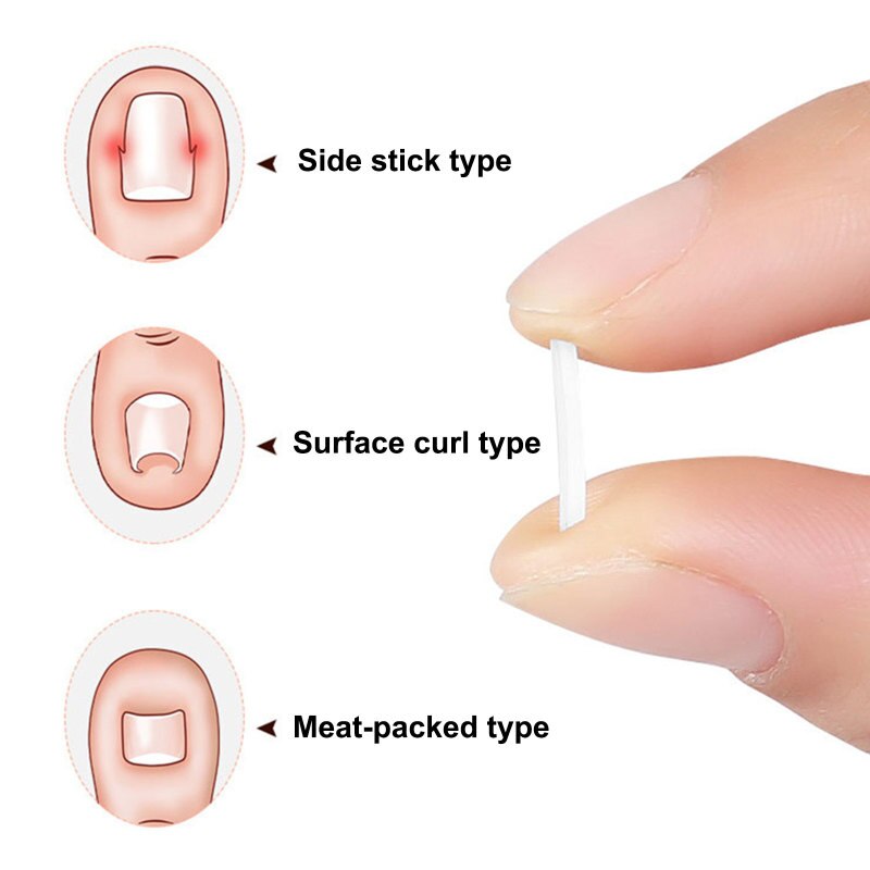 Close-up of the Toe Nail Support Pad in use