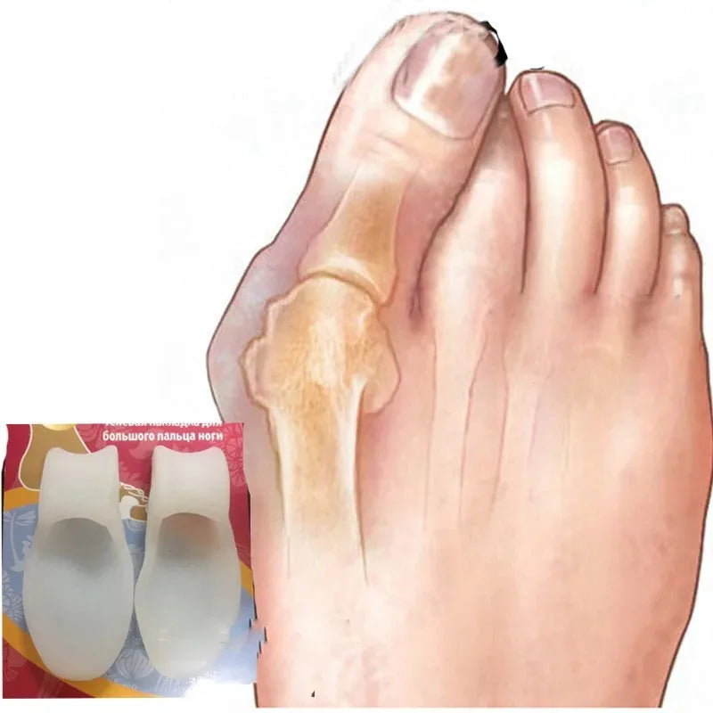 Demonstration of the toe separator's comfortable fit on a foot